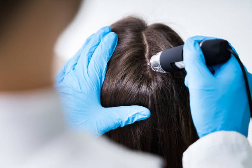 Why Exosome Hair in Dubai Is Gaining Popularity Today