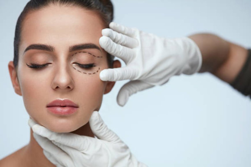 How Blepharoplasty Dubai Refreshes Tired-Looking Eyes Today