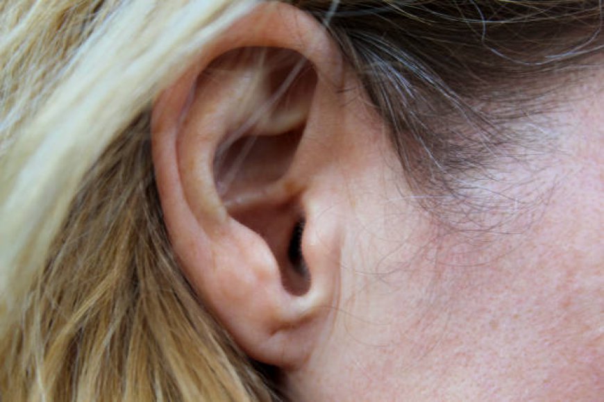 Top Earlobe Surgery in Dubai Benefits for Earring Wear