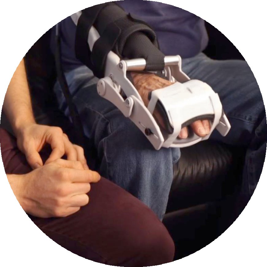 How the Motus Nova Hand Device Supports Smarter Stroke and MS Rehabilitation