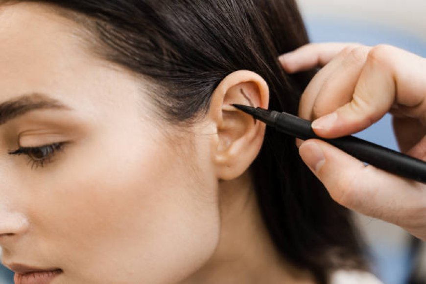 How Ear Reshaping | Otoplasty Dubai Creates Natural Results