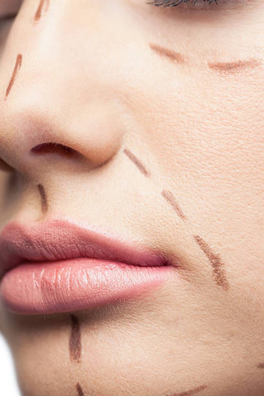 How Facial Scar Revision in Dubai Restores Smooth Skin