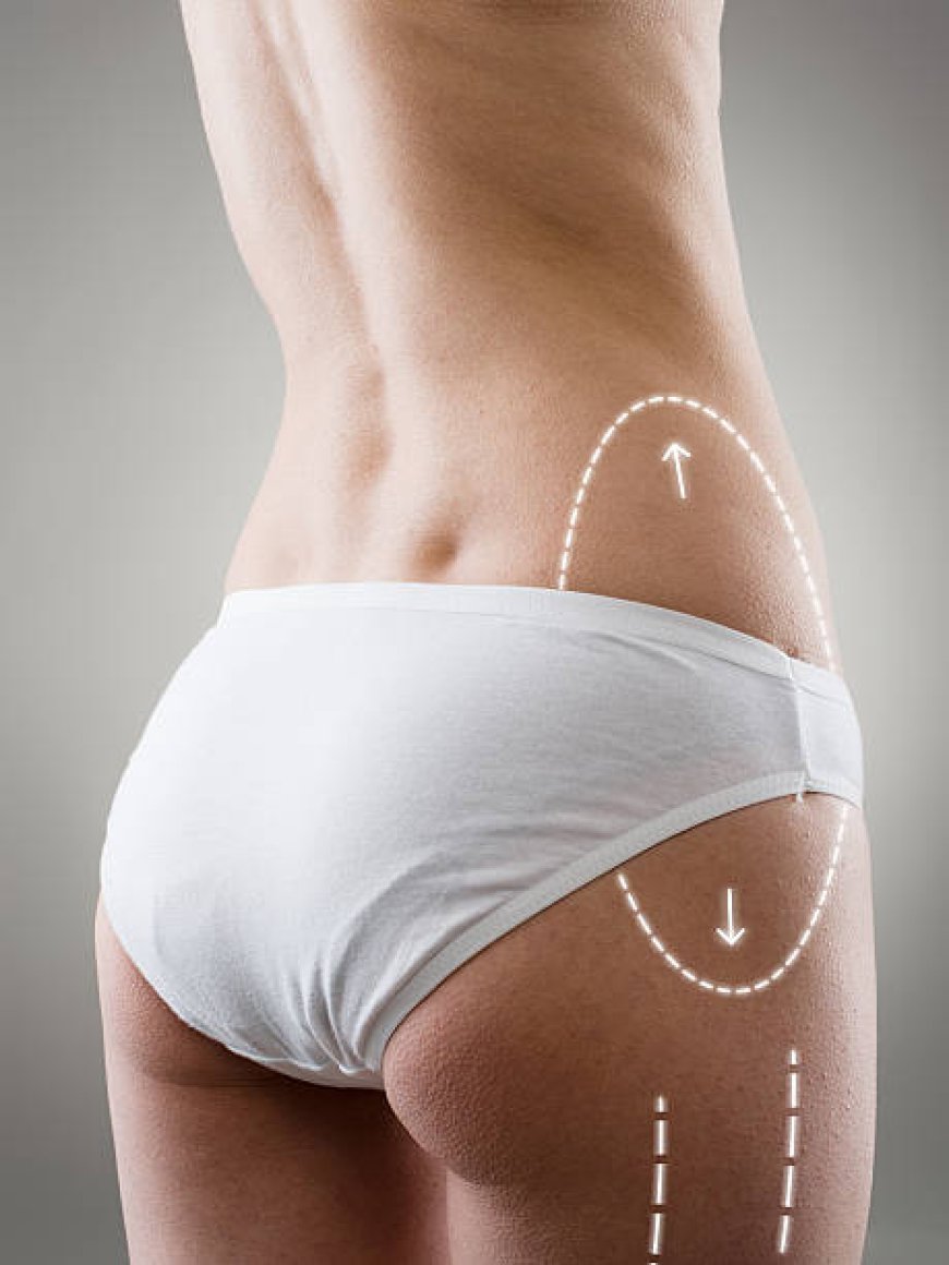 How Does Vaser Quad Liposuction in Dubai Work?