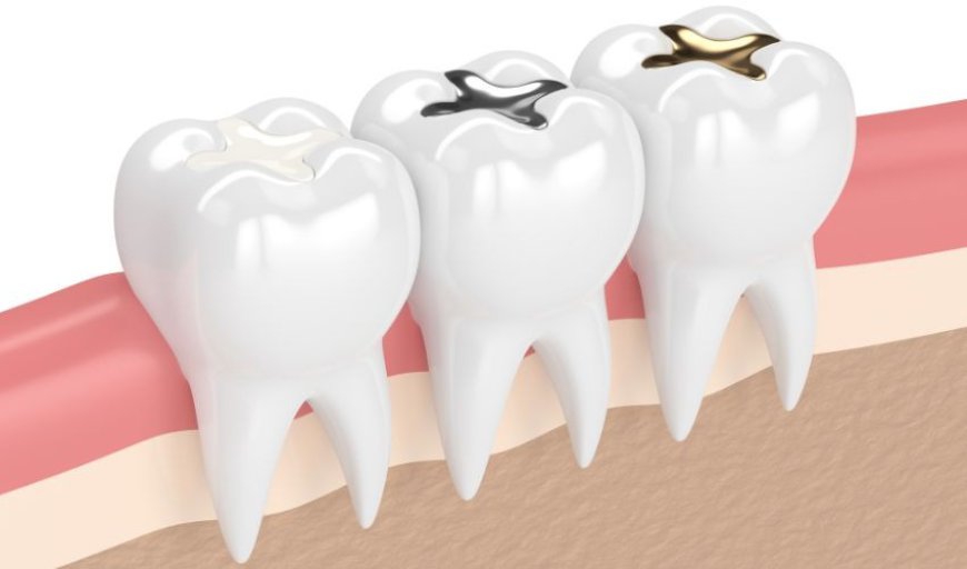 Best Teeth Filling Solutions with Trusted Dental Tourism by Meditouring