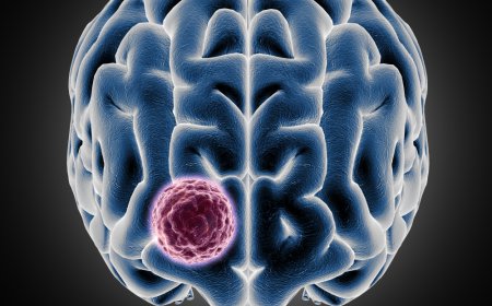 Neuroendocrine Tumors Market Size, Trends, and Growth Forecast 2026-2033