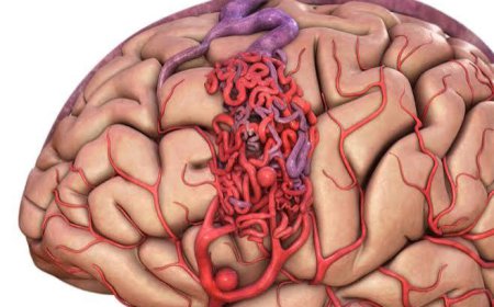 Arteriovenous Malformations Market: Size, Trends, and Strategic Growth Insights