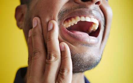 Impacted Wisdom Teeth: Symptoms, Risks, and Treatment Options