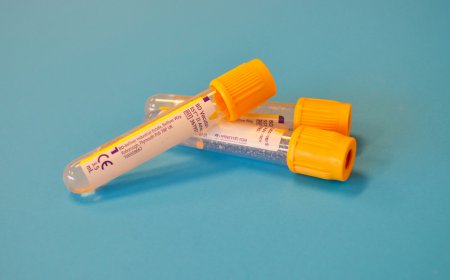 Blood Collection Tubes Market Size, Trends, and Growth Analysis 2026-2033
