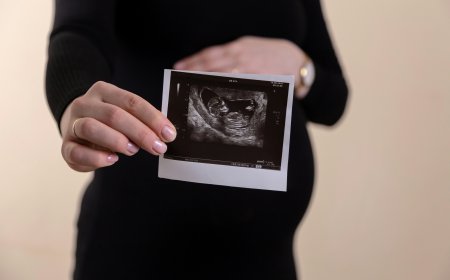 Global Ultrasound Devices Market Size, Trends, and Growth Outlook 2026-2033