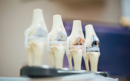 Knee Implants Market Size, Trends, and Growth Forecast 2026-2033