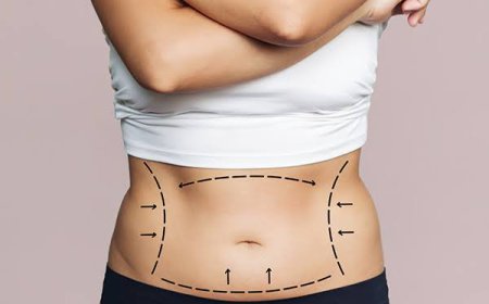 Obesity Treatment in Dubai: Comprehensive Weight Management with Medical Guidance