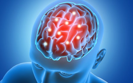 Transient Ischemic Attack Market: Size, Trends, and Strategic Insights 2026-2033