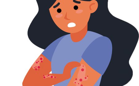 Plaque Psoriasis Market Size, Trends, and Growth Forecast 2026-2033