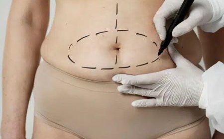 Why International Patients Choose a Tummy Tuck in Dubai