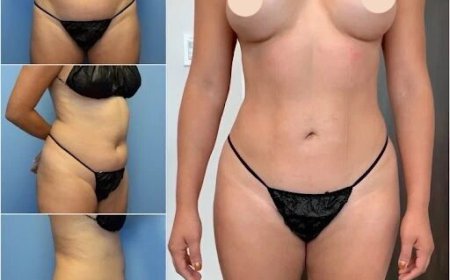 Body Contouring in Dubai: Expert Tips for Beautiful Body Proportions