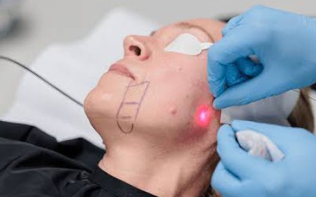 Non-surgical Face Lifting in Dubai: Youthful Facial Contours