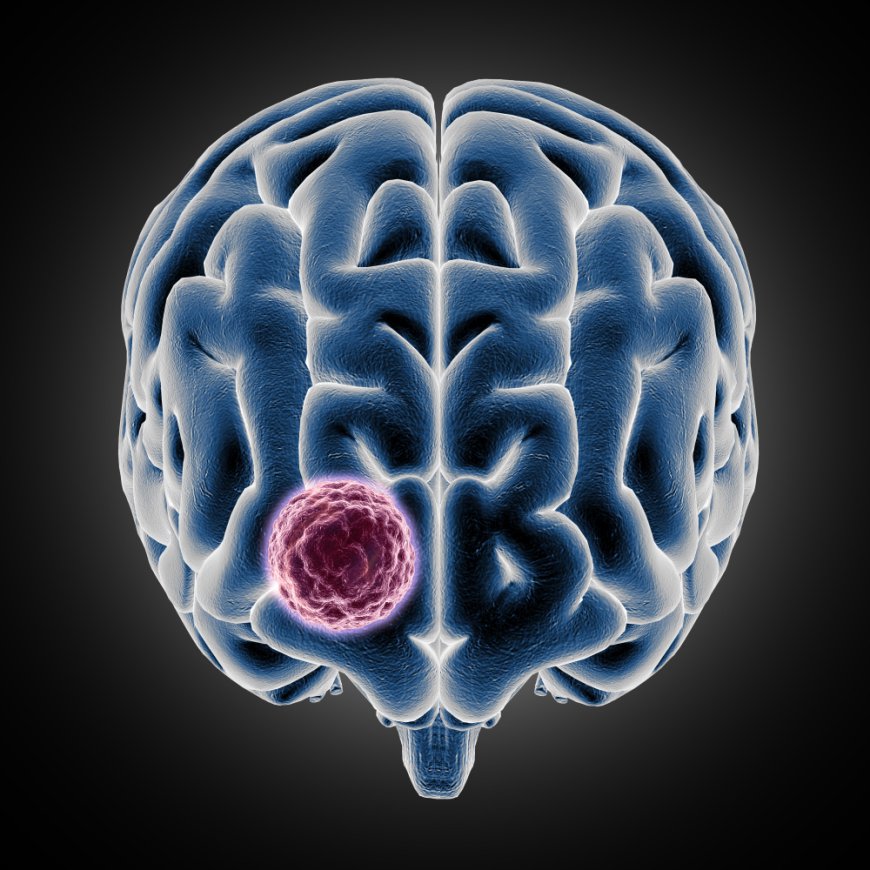 Neuroendocrine Tumors Market Size, Trends, and Growth Forecast 2026-2033