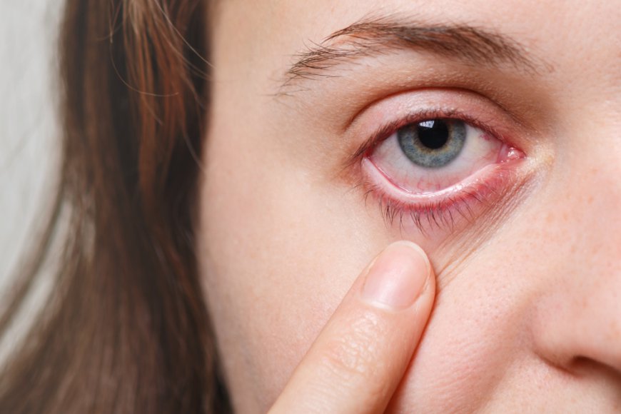 Ocular Hypertension Market Size, Trends, and Growth Forecast 2026-2033