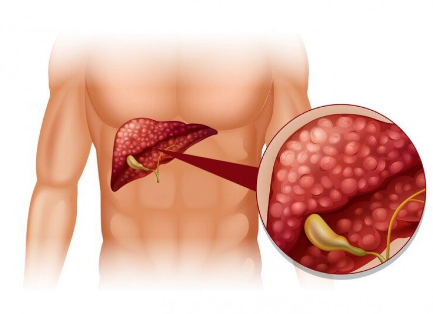 Advanced Liver Cancer Market Size, Trends, and Growth Analysis 2026-2033