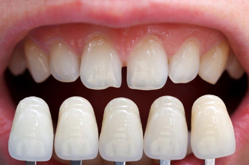 Why Regular Checkups with a Dentist in Newport Beach Save You Time and Money