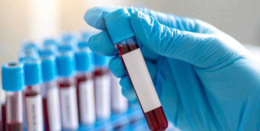 Health Checkup: Benefits, Types, Tests Included & Why Regular Screening Matters