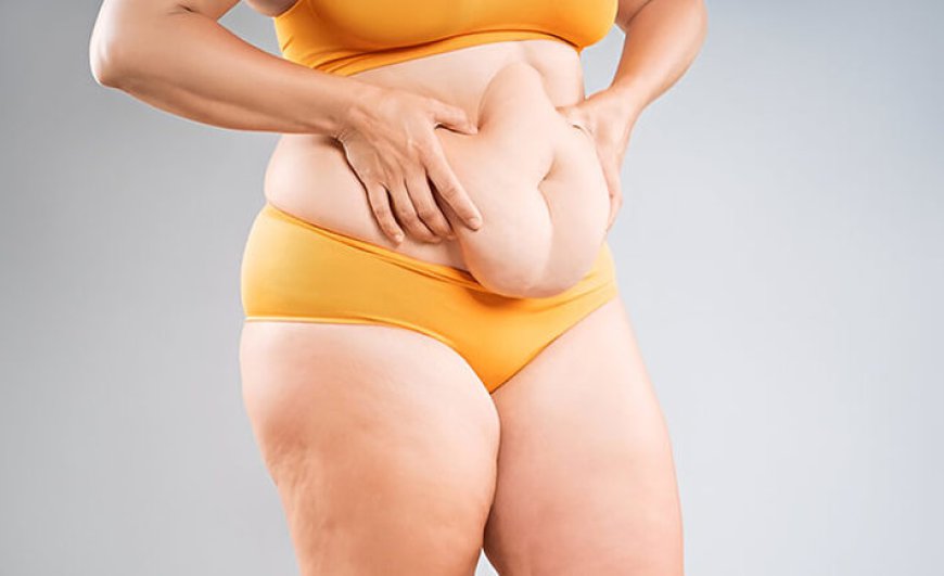 Tummy Tuck Surgery in Delhi - Dr Rajat Gupta