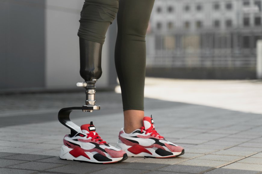 Global Robotic Prosthetics Market Size, Trends, and Growth Forecast 2026-2033