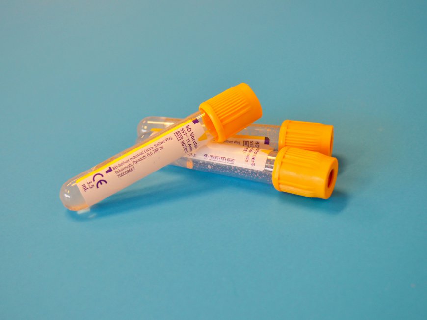 Blood Collection Tubes Market Size, Trends, and Growth Analysis 2026-2033