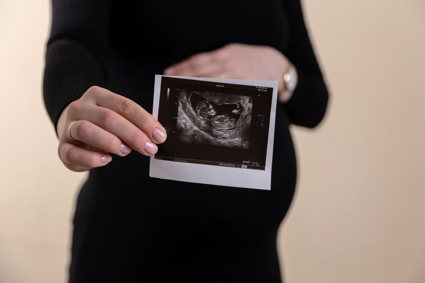 Global Ultrasound Devices Market Size, Trends, and Growth Outlook 2026-2033