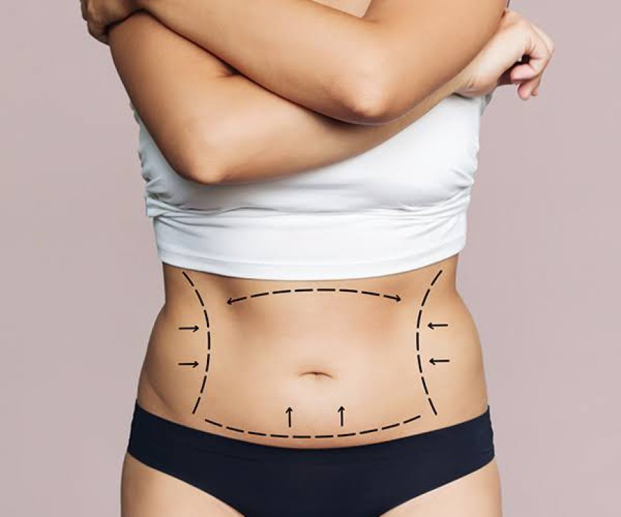 Obesity Treatment in Dubai: Comprehensive Weight Management with Medical Guidance