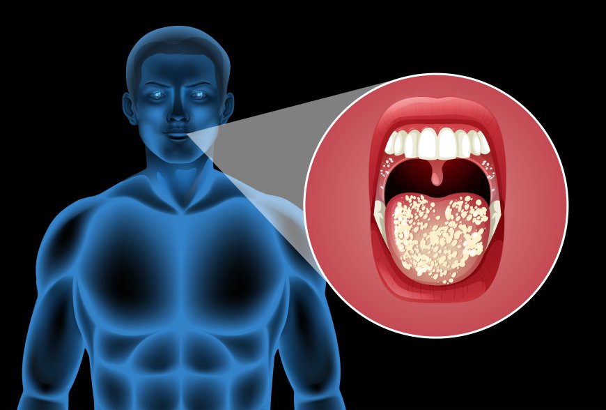 Salivary Gland Infection Market Size, Trends, and Growth Analysis 2026-2033