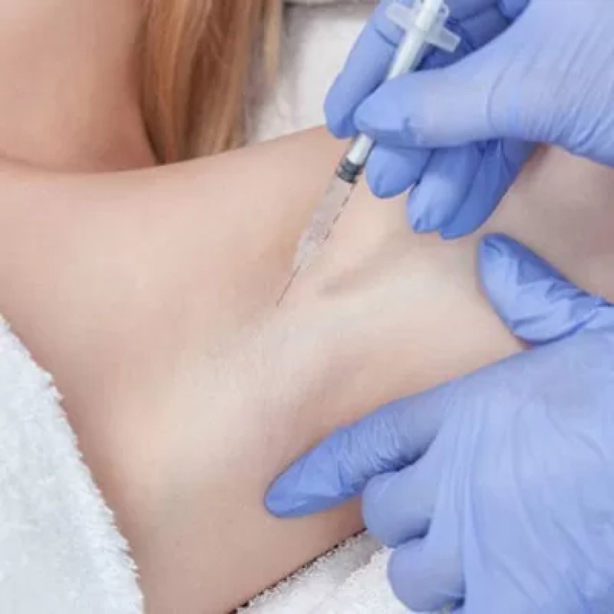 Can Botox Help Control Excessive Perspiration in Multiple Areas of the Body?