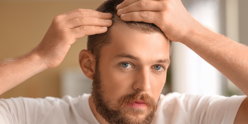 Hair Transplant for Crown Baldness: Grafts, Results and Recovery