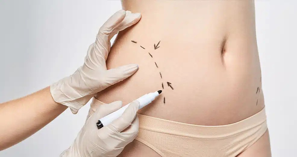 Body Contouring in Dubai: Who Is a Good Candidate?