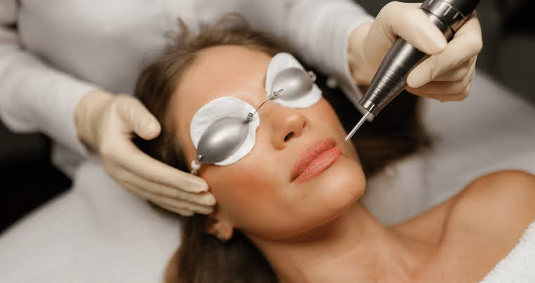 Laser Treatment for Pigmentation: How to Prepare Before Your Session