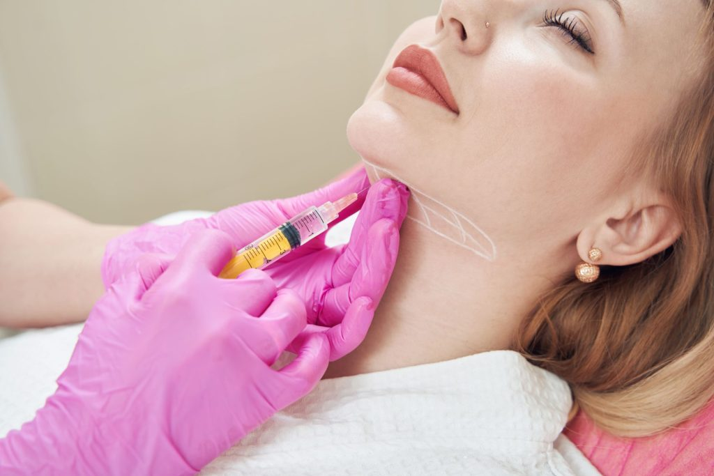 What Side Effects Are Common After Kybella Injections?