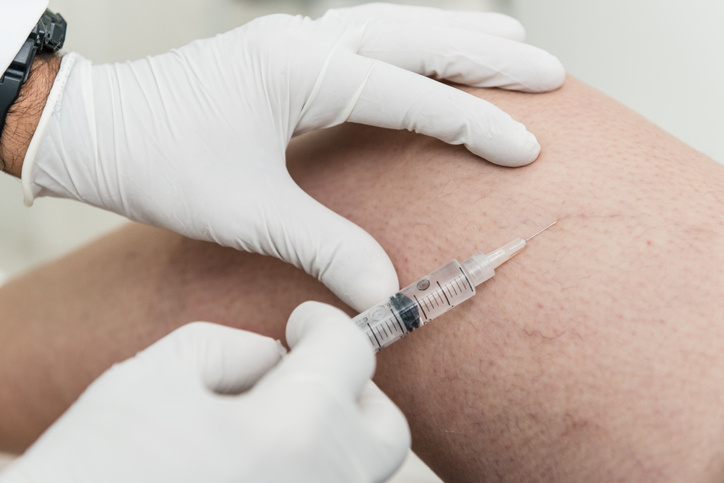Smooth Out Visible Blue Veins Using Sclerotherapy