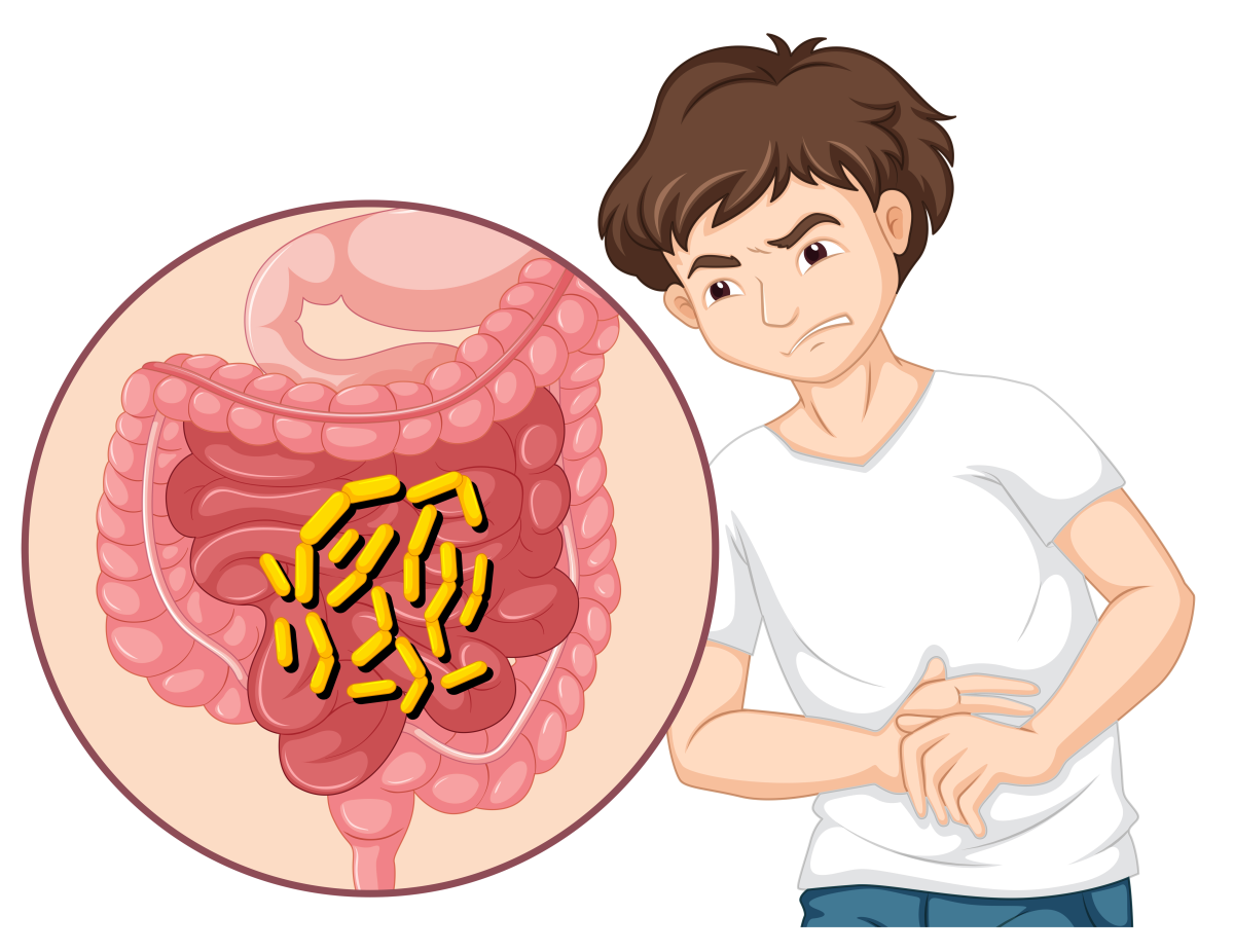 Necrotising Enterocolitis Market Size, Trends, and Growth Opportunities 2026-2033