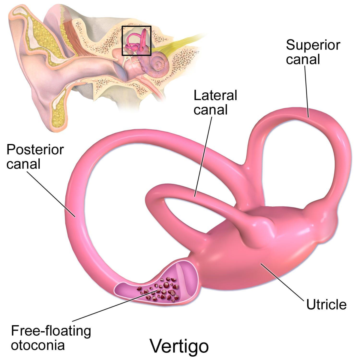 What Are The Symptoms Of Exposure-Related Sound And Vestibular Injury?