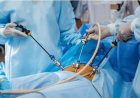 Digestive Ease After Endoscopic Balloon Extraction