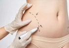 Body Contouring in Dubai: Who Is a Good Candidate?
