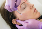 Rough Texture Issues? Vampire Facial Smooths Skin Deeply