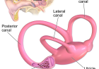 What Are The Symptoms Of Exposure-Related Sound And Vestibular Injury?