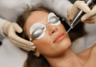 Laser Treatment for Pigmentation: How to Prepare Before Your Session