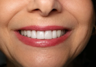 Why Choosing the Right Family Dentist Changes Everything for Your Household