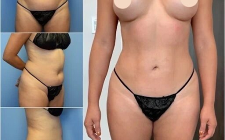 Best Doctors in Dubai for Body Contouring and Enhanced Body Proportions