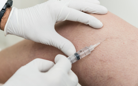 Smooth Out Visible Blue Veins Using Sclerotherapy