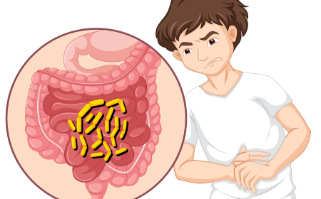 Necrotising Enterocolitis Market Size, Trends, and Growth Opportunities 2026-2033