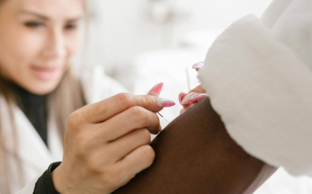 Microneedling Acupuncture Aftercare: 5 Healing Tips