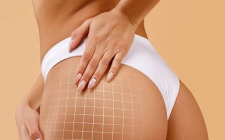 Butt Fillers in Dubai: Modern Aesthetic Enhancement